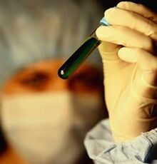 kako se testirati na parazite