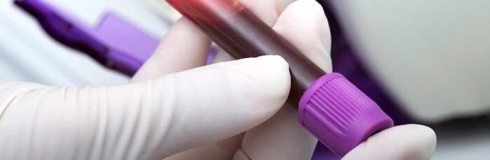krvi za testiranje na parazite