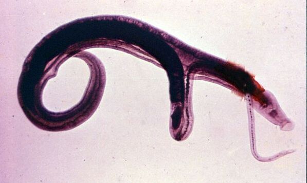 Šistosomi su jedni od najčešćih i najopasnijih parazita